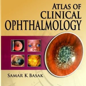 Atlas of Clinical Ophthalmology 2nd Edition (2013)