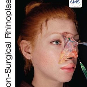 Non-Surgical Rhinoplasty, Riccardo Nocini, Ali Pirayesh