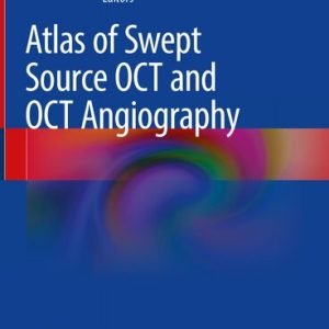 Atlas of Swept Source OCT and OCT Angiography