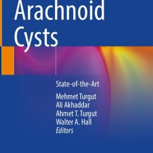 Arachnoid Cysts: State-of-the-Art